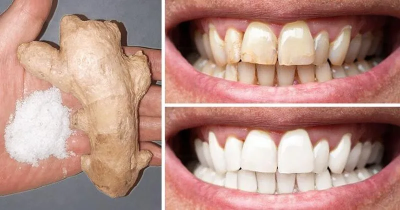 أغرب 5 طرق طبيعية لتبييض الأسنان