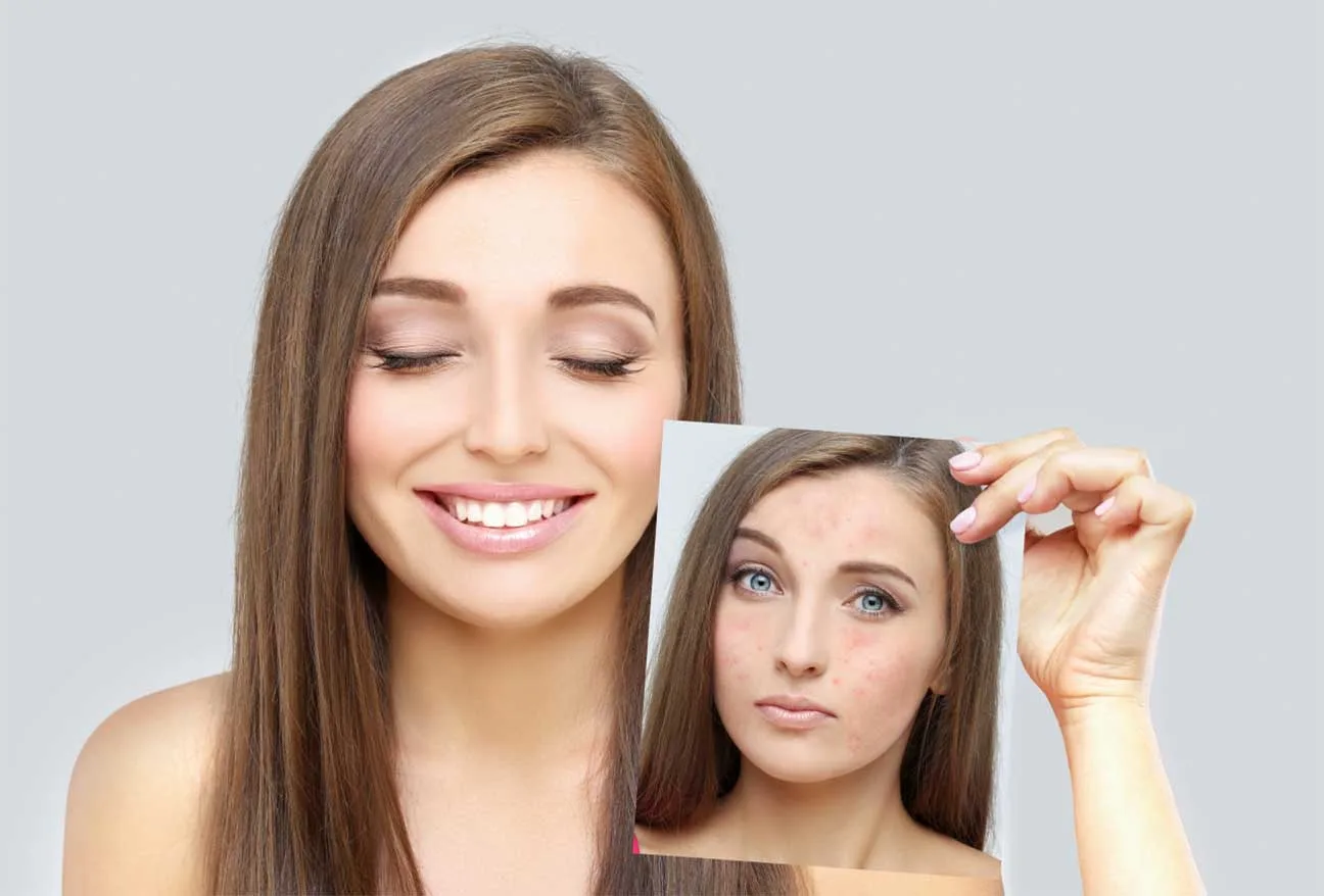 5 نصائح لتقليل التوتر وتحسين نضارة الوجه