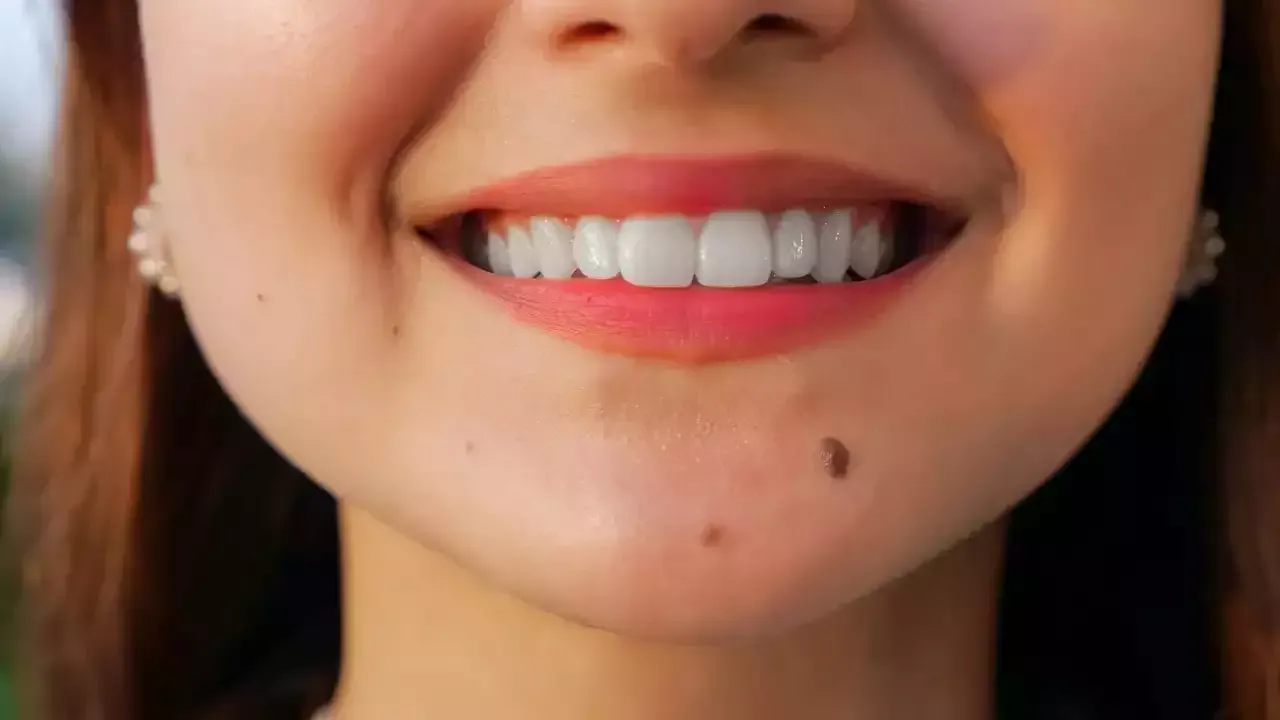 أسباب ظهور شامات صغيرة في الوجه