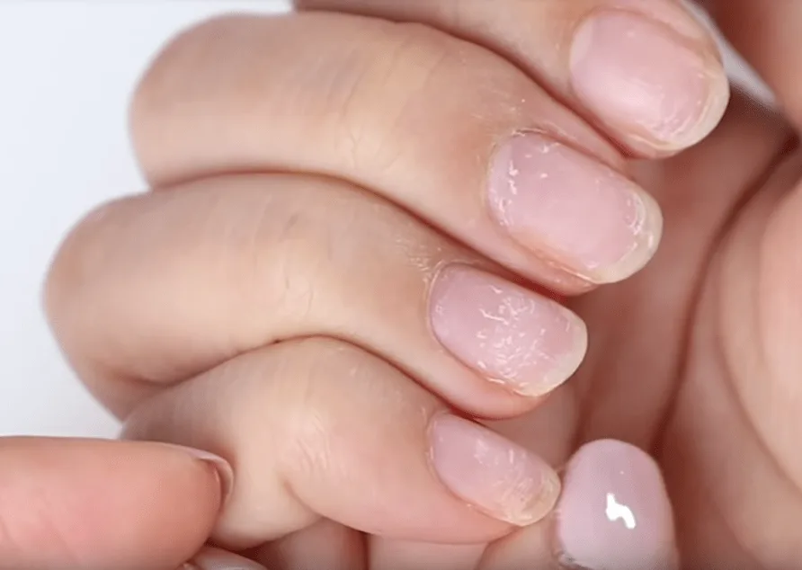 Woman shares gruesome pics showing what years of gel manicures have done to her nails - and it'll probably put you off them for life | The Sun