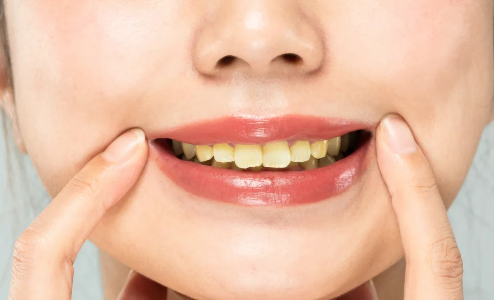 6 أسرار للحصول على أسنان أكثر بياضاً