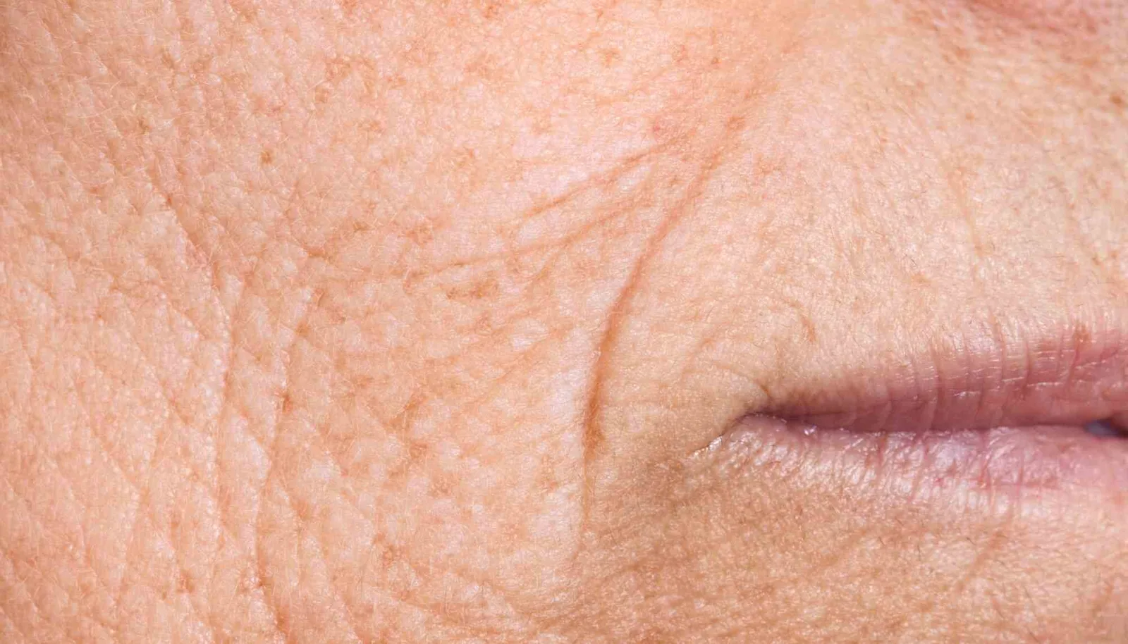 أفضل 8 طرق تخلصك من التجاعيد