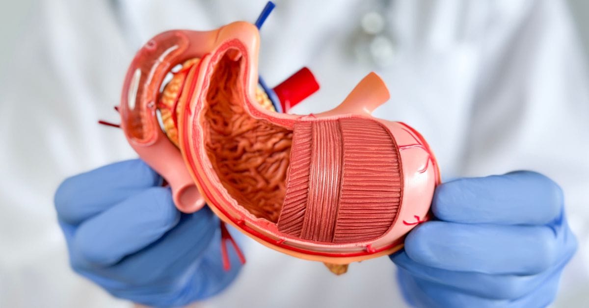 مخاطر عملية تكميم المعدة 