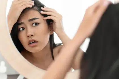 أسباب صلع النساء من الأمام